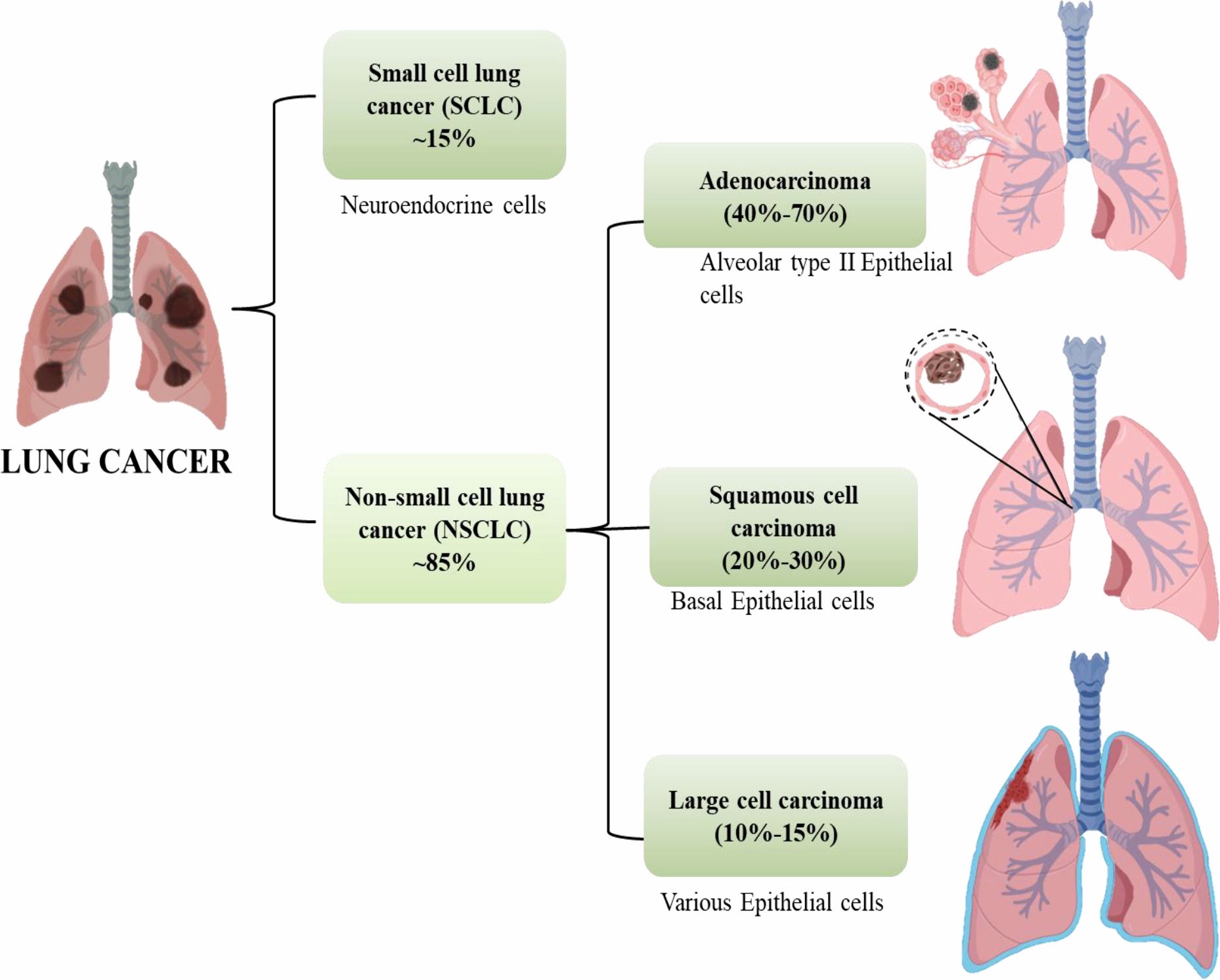 Advanced Lung cancer : more treatment choices. – Dr S Sundar